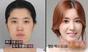 韩国整容图片,揭秘明星网红的蜕变之路