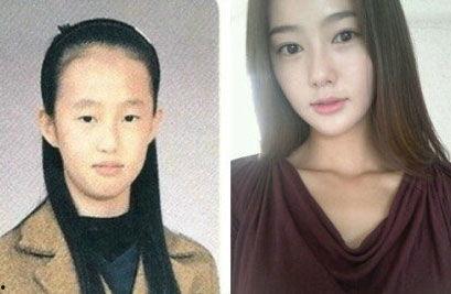 韩国整容图片,揭秘明星网红的蜕变之路