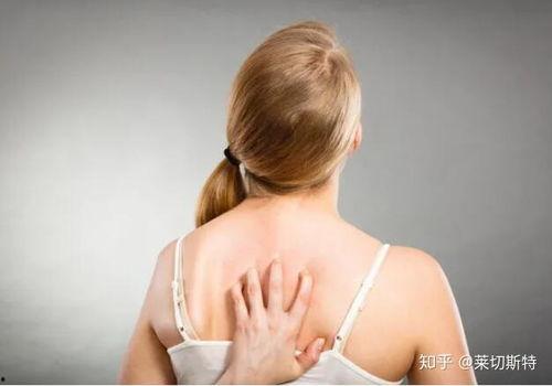 大腿皮炎图片大全,大腿皮炎症状解析与图片展示