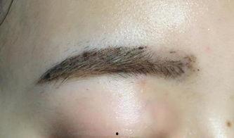 纹眉后正常掉痂图片,纹眉术后正常掉痂过程图解