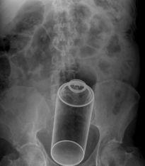 日本阴部图片真人,真实生活下的私密视角